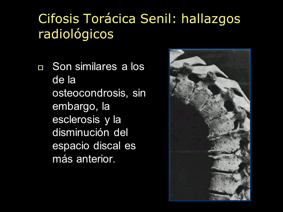 A mí los dolores agudos raros en la espalda que esto